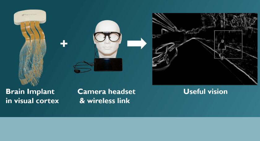 FDA Grants Breakthrough Device Designation to ReVision Implant Visual Cortex Prosthesis